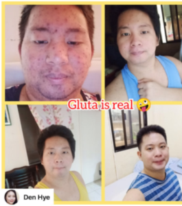 White Allure Glutathione and Rose-C White Vitamin C Combo photo review