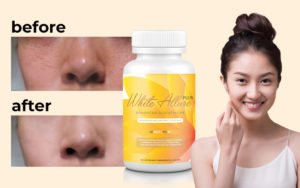 glutathione whiter potions