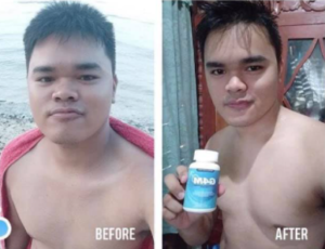 G4M Glutathione for Men and Rose-C White Vitamin C Bundle - FREE SOAP & TEE photo review