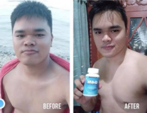 G4M Glutathione for Men and BeauOxi White-C Vitamin C Bundle - FREE SOAP & TEE photo review